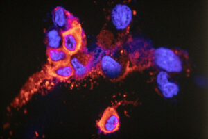 Scientists at the University of Hong Kong (HKU) have become the first in Asia to succeed in isolating the new Omicron